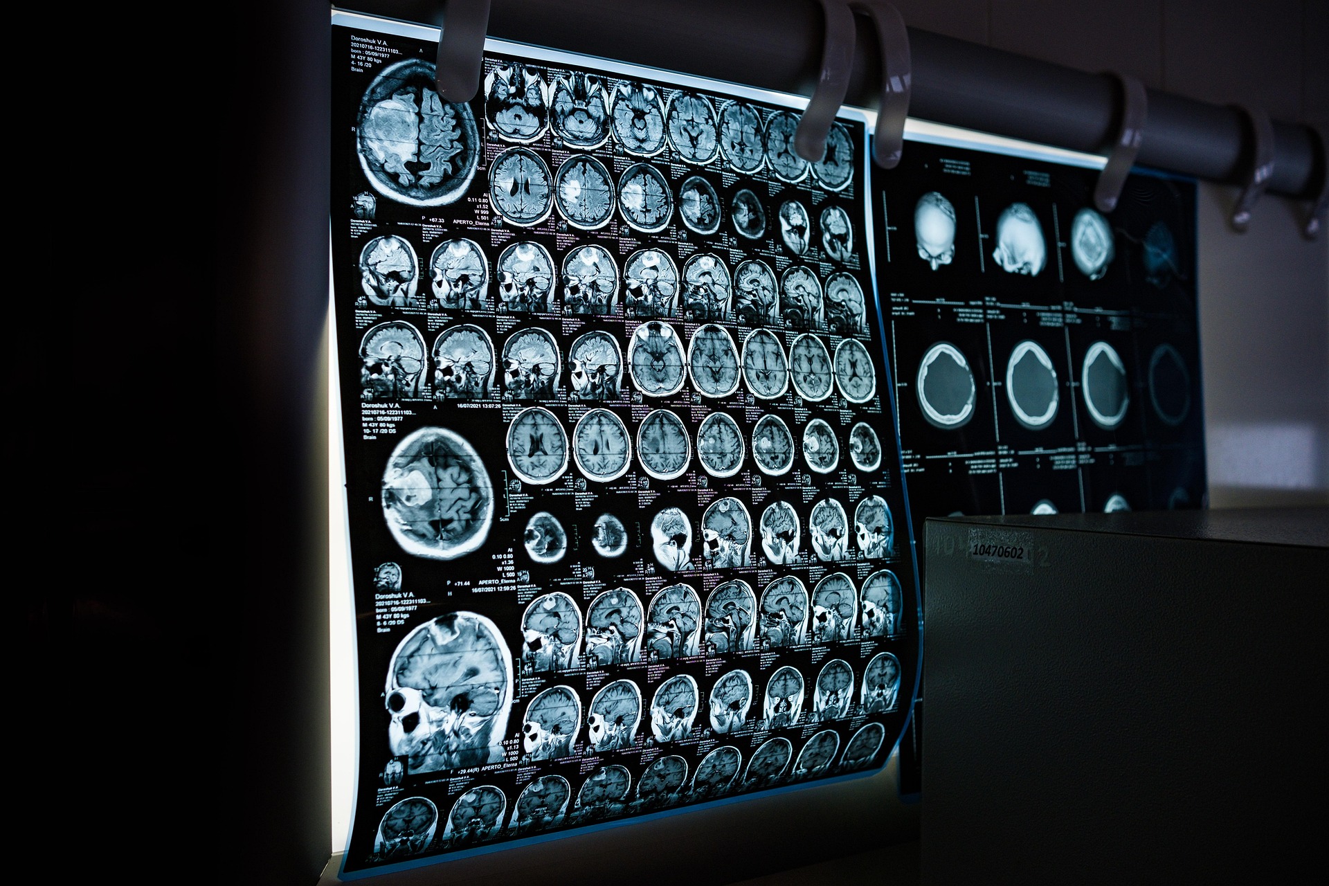 A.I in Medical Industry
